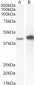 AMACR Antibody (C-Term)